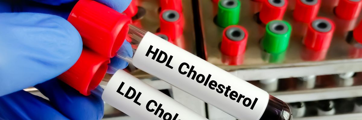 Egyre több ember küzd magas koleszterinszinttel