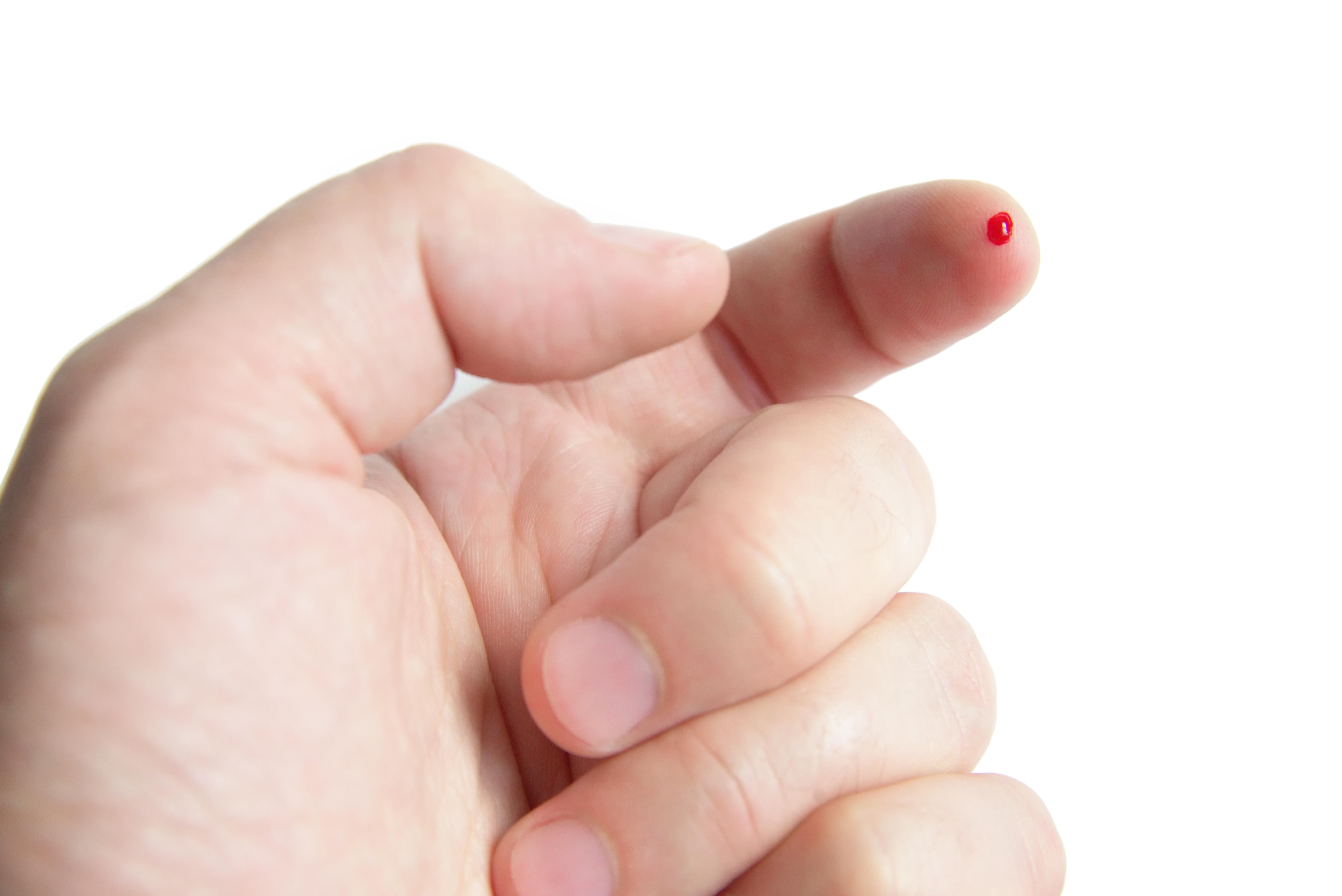 A teszteléshez az ujjbegyből kell vért venni