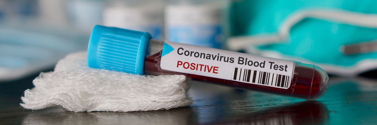Kijöttek a hétvégi friss adatok a koronavírus hazai terjedéséről